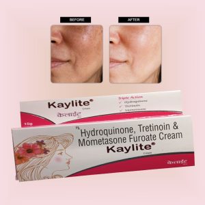 Kaylite face cream for skin whitening