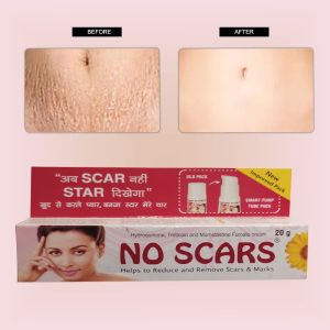 No-Scars Cream to remove and reduce Scars and Marks
