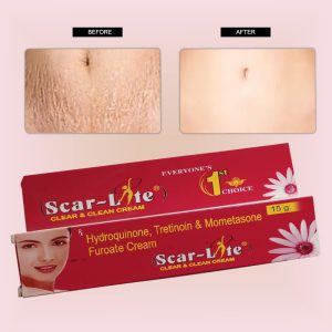 Scar-lite cream