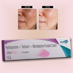 Skinlite Cream for skin whitening